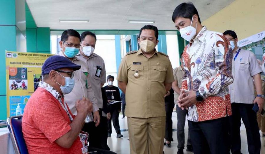 Hari Kusta Sedunia, Arief Harapkan Penderita Kusta Tetap Produktif